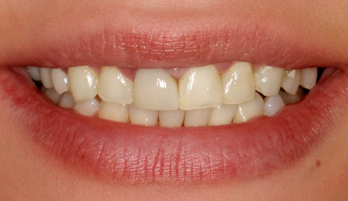 Before image